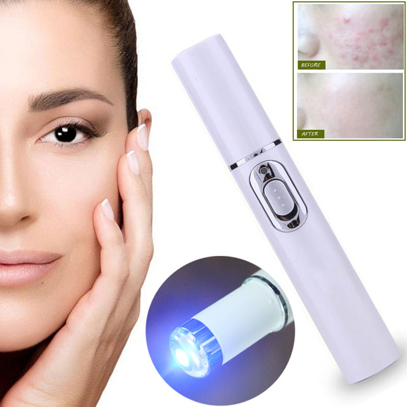 Caneta Blu-ray para remoção de acne, olheiras e bolsas sob os olhos