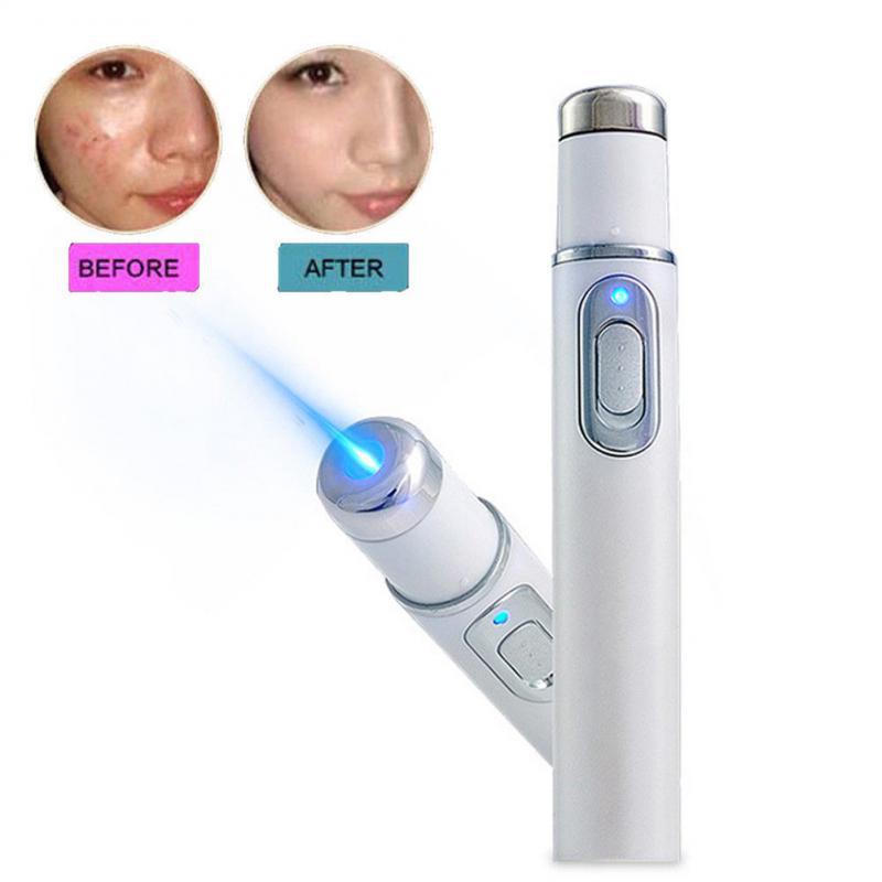 Caneta Blu-ray para remoção de acne, olheiras e bolsas sob os olhos